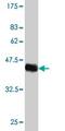 Hematological and neurological expressed 1 protein antibody, ab57274, Abcam, Western Blot image 