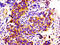 Collagen Type VI Alpha 2 Chain antibody, LS-C671886, Lifespan Biosciences, Immunohistochemistry paraffin image 