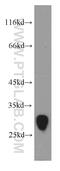 Transmembrane Protein 41A antibody, 20768-1-AP, Proteintech Group, Western Blot image 