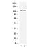 Transient receptor potential cation channel subfamily M member 4 antibody, R32286, NSJ Bioreagents, Western Blot image 