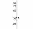 C-C Motif Chemokine Receptor 1 antibody, F48896-0.4ML, NSJ Bioreagents, Western Blot image 