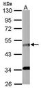 Interleukin-5 receptor subunit alpha antibody, GTX103418, GeneTex, Western Blot image 