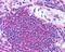 TULA antibody, GTX89140, GeneTex, Immunohistochemistry paraffin image 