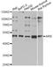 Autoimmune Regulator antibody, LS-C749194, Lifespan Biosciences, Western Blot image 