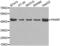 Pro-Apoptotic WT1 Regulator antibody, LS-C332345, Lifespan Biosciences, Western Blot image 