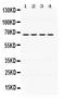 Nuclear Receptor Subfamily 4 Group A Member 1 antibody, PB9766, Boster Biological Technology, Western Blot image 