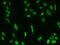 Myocyte-specific enhancer factor 2D antibody, GTX02187, GeneTex, Immunocytochemistry image 