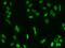 Myocyte Enhancer Factor 2D antibody, GTX02187, GeneTex, Immunocytochemistry image 