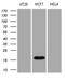 Anterior Gradient 2, Protein Disulphide Isomerase Family Member antibody, LS-C795126, Lifespan Biosciences, Western Blot image 
