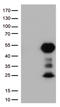 Fc Fragment Of IgG Receptor IIa antibody, LS-C799217, Lifespan Biosciences, Western Blot image 