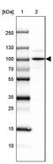 SEC63 Homolog, Protein Translocation Regulator antibody, PA5-62771, Invitrogen Antibodies, Western Blot image 