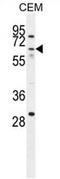 Zinc Finger Protein 674 antibody, AP54710PU-N, Origene, Western Blot image 