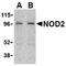 Nucleotide Binding Oligomerization Domain Containing 2 antibody, LS-B2721, Lifespan Biosciences, Western Blot image 