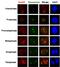NUAK Family Kinase 2 antibody, 11592-1-AP, Proteintech Group, Immunofluorescence image 