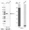 Beta-1,4-Galactosyltransferase 1 antibody, PA5-52744, Invitrogen Antibodies, Western Blot image 