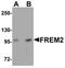 FRAS1 Related Extracellular Matrix 2 antibody, orb75453, Biorbyt, Western Blot image 
