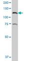 Catenin Delta 2 antibody, H00001501-A01, Novus Biologicals, Western Blot image 