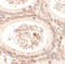 Spermatogenesis Associated 3 antibody, A16295, Boster Biological Technology, Immunohistochemistry paraffin image 