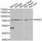 Hyaluronan Synthase 3 antibody, A13498, ABclonal Technology, Western Blot image 