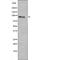 FES Proto-Oncogene, Tyrosine Kinase antibody, PA5-64504, Invitrogen Antibodies, Western Blot image 