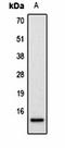 Iduronate 2-Sulfatase antibody, orb333732, Biorbyt, Western Blot image 