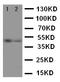 Vitamin D Receptor antibody, LS-C313118, Lifespan Biosciences, Western Blot image 