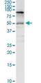 Solute Carrier Family 3 Member 2 antibody, H00006520-D01P, Novus Biologicals, Western Blot image 