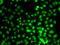 Lysine Methyltransferase 5A antibody, 22-850, ProSci, Immunofluorescence image 