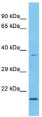 MAX Dimerization Protein 3 antibody, TA345426, Origene, Western Blot image 