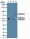 Fms Related Tyrosine Kinase 1 antibody, LS-C296963, Lifespan Biosciences, Western Blot image 