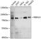 RNA Binding Motif Protein 14 antibody, 14-163, ProSci, Western Blot image 