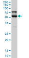 Serine/Threonine Kinase 17a antibody, LS-B4482, Lifespan Biosciences, Western Blot image 