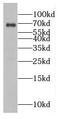 Eukaryotic Translation Initiation Factor 3 Subunit L antibody, FNab02713, FineTest, Western Blot image 