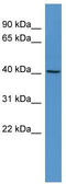 Ras association domain-containing protein 6 antibody, TA342692, Origene, Western Blot image 