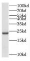 Centrosomal Protein 19 antibody, FNab01107, FineTest, Western Blot image 