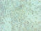 Alsin Rho Guanine Nucleotide Exchange Factor ALS2 antibody, LS-C379194, Lifespan Biosciences, Immunohistochemistry paraffin image 