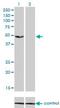 Adenylate Kinase 8 antibody, H00158067-M01, Novus Biologicals, Western Blot image 