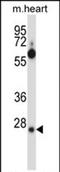 Serine And Arginine Rich Splicing Factor 8 antibody, PA5-71815, Invitrogen Antibodies, Western Blot image 