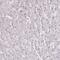 BRCA1 Associated RING Domain 1 antibody, PA5-60850, Invitrogen Antibodies, Immunohistochemistry paraffin image 