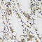 Kinetochore Scaffold 1 antibody, 14-798, ProSci, Immunohistochemistry paraffin image 