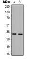 High Mobility Group 20B antibody, LS-C356102, Lifespan Biosciences, Western Blot image 