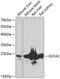 Glutathione S-Transferase Alpha 2 antibody, GTX55651, GeneTex, Western Blot image 