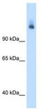 Carbamoyl-Phosphate Synthase 1 antibody, TA338262, Origene, Western Blot image 