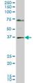 Gastrulation and brain-specific homeobox protein 2 antibody, H00002637-M02, Novus Biologicals, Western Blot image 