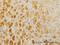 Twist-related protein 2 antibody, H00117581-M01, Novus Biologicals, Immunohistochemistry paraffin image 