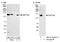 SPT5 Homolog, DSIF Elongation Factor Subunit antibody, NB110-40593, Novus Biologicals, Western Blot image 
