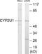 Cytochrome P450 Family 2 Subfamily U Member 1 antibody, EKC1917, Boster Biological Technology, Western Blot image 