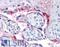 Integrin Subunit Beta 3 antibody, LS-B4046, Lifespan Biosciences, Immunohistochemistry frozen image 