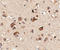 SLIT And NTRK Like Family Member 6 antibody, A09006, Boster Biological Technology, Immunohistochemistry paraffin image 