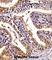 Pleckstrin Homology Like Domain Family A Member 2 antibody, abx028101, Abbexa, Western Blot image 